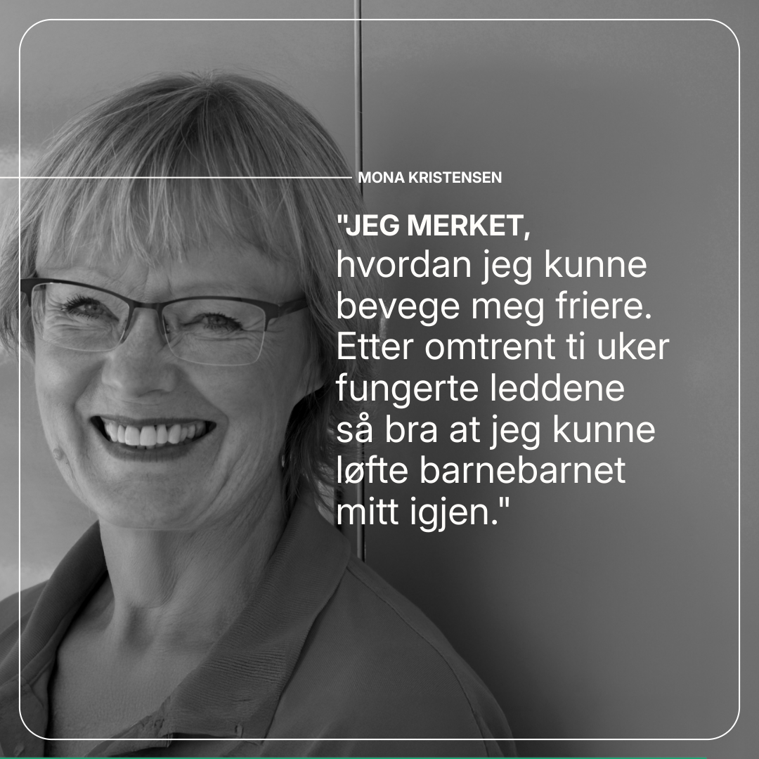 Movizin Complex kosttilskudd med ingefær, nype og boswellia for bedre leddhelse og bevegelighet.